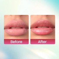 Swiss Beauty Kiss Kandy Lip Balm Water Melon - 10ml | with Olive Oil | Soft & Smooth Lips | Long-lasting Hydration | Non- Sticky & Lightweight .