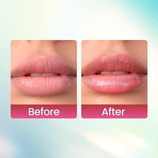 Swiss Beauty Kiss Kandy Lip Balm Water Melon - 10ml | with Olive Oil | Soft & Smooth Lips | Long-lasting Hydration | Non- Sticky & Lightweight .