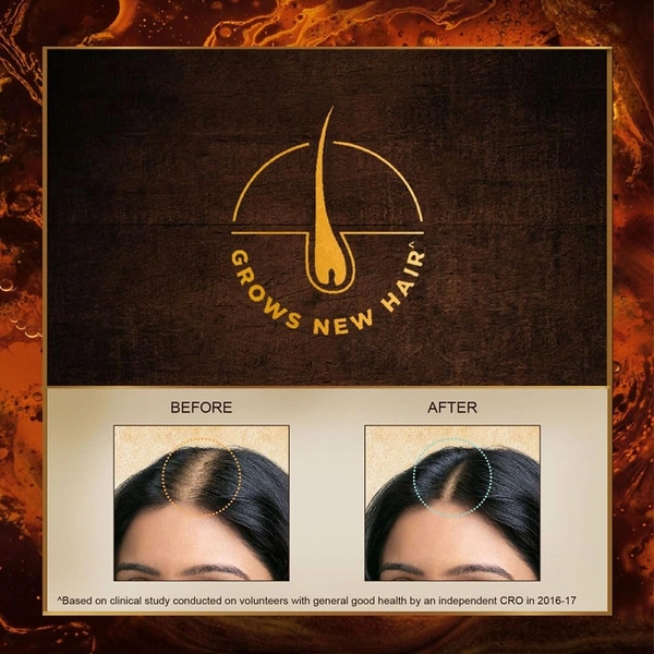  Indulekha Bringha Ayurvedic Hair Oil: 100 ml - 100ml