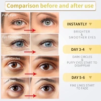 24K Gold Under Eye Patches Personal Care