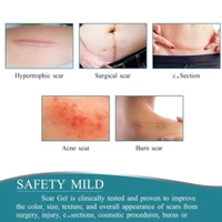 Silicone scar tape for surgical scars Removal 