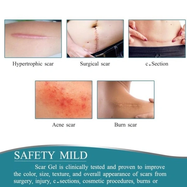 Silicone scar tape for surgical scars Removal 