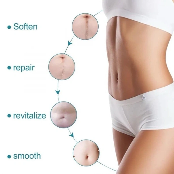 Silicone scar tape for surgical scars Removal 