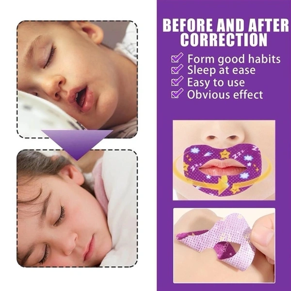 Anti Snoring Lips Strips 30 Pcs