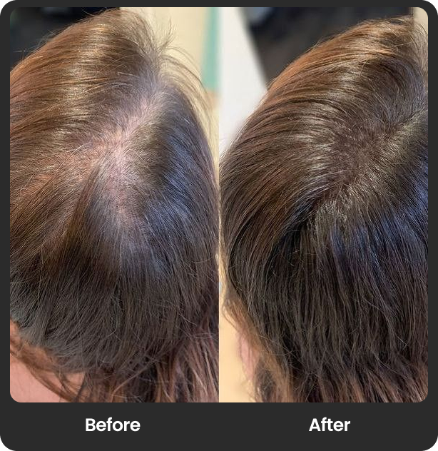 Combined before/after