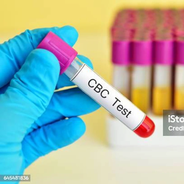 CBC (Complete Blood Count)
