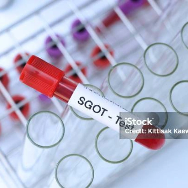 SGOT 