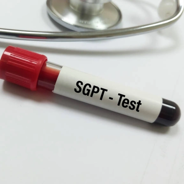 SGPT 