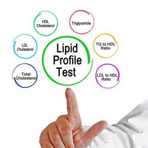 LIPID PROFILE 