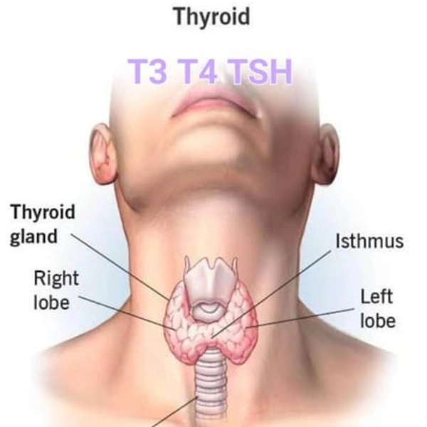 T3T4 TSH 