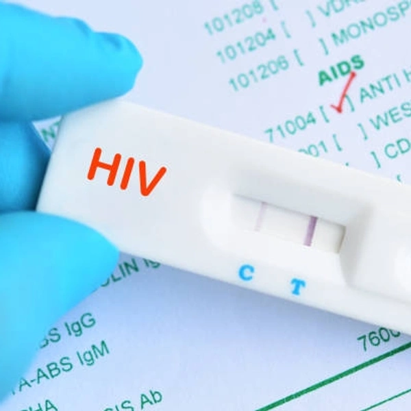 HIV 1&2 350
