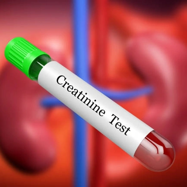 SR. CREATININE 