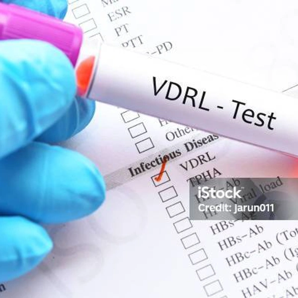 VDRL