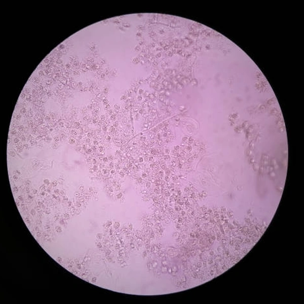 SEMEN ANALYSIS MICROCOPIC