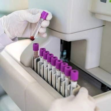 Blood Test