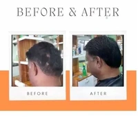 Reborn Naturals BEARDOIL 3IN1 Hair Oil  (100 ml) - 100 ml