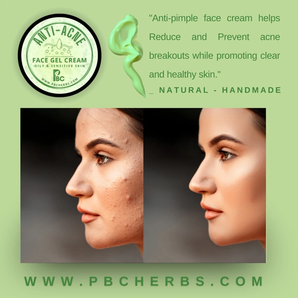 Anti Acne Face Gel Cream - 50g