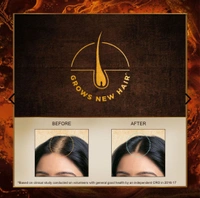 Indulekha Hair  Oil - 250 Ml