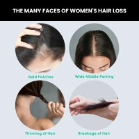 HAIR SERUM 2.0 HAIR GROWTH SERUM FOR MEN AND WOMEN (50 ML) PACK OF @ - 2