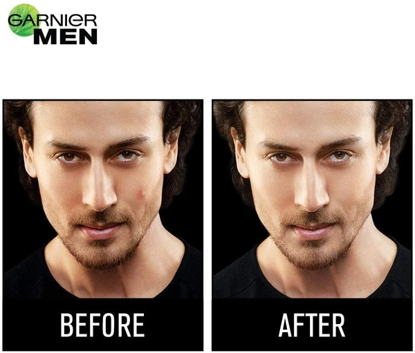 Garnier Men Acno Fight Pimple Clearing Whitening Day Cream - 2-3 days on orders over ₹499 shipped by Selection House, 45 gm