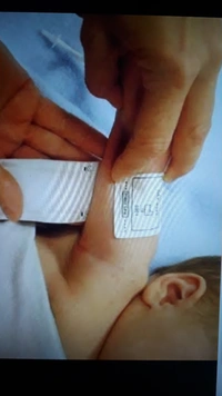 Nibp Cuff Reusable & Disposable 